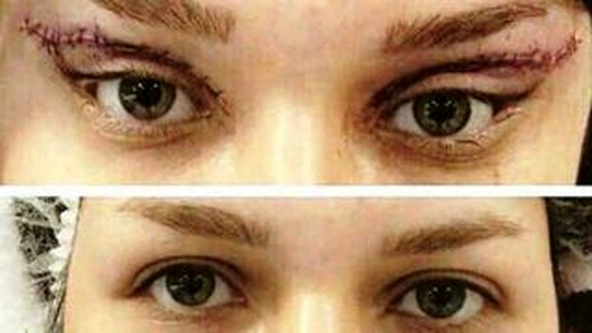 جراحی گوش الاغی و چشم گربهای در آرایشگاهها