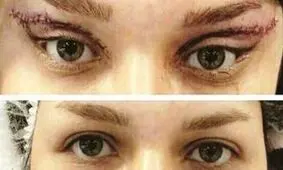 جراحی گوش الاغی و چشم گربه‌ای در آرایشگاه‌ها
