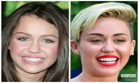 کلیپ حیرت انگیز خانم ها قبل و بعد از آرایش