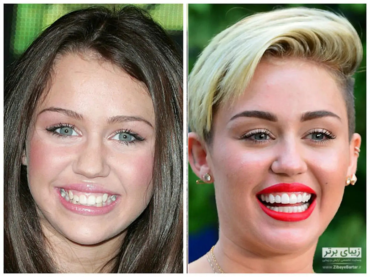 کلیپ حیرت انگیز خانم ها قبل و بعد از آرایش