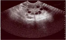 فیبروم چیست