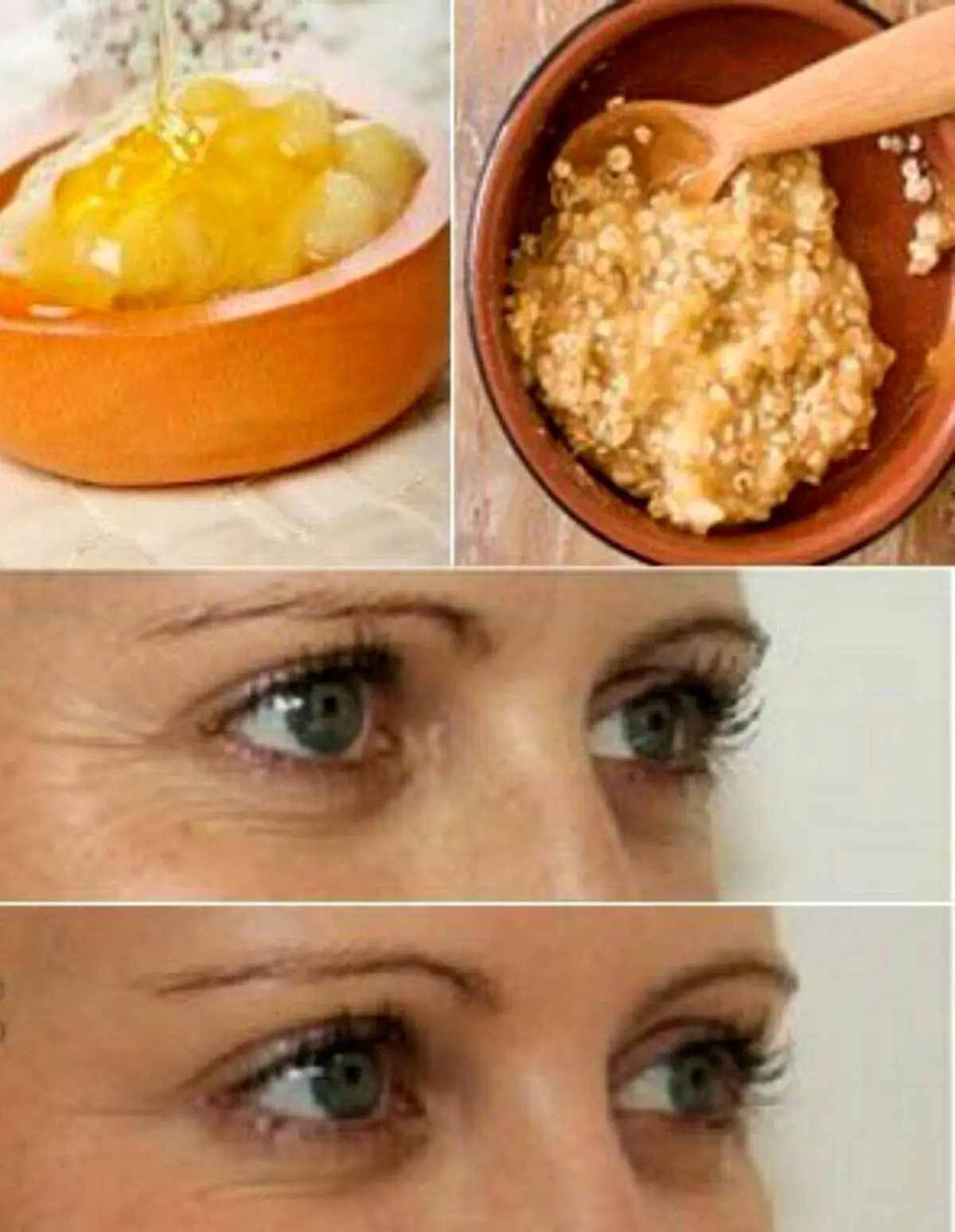 ماسک چین و چروک