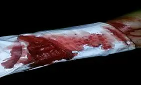 حمله به ۲ طلبه نیشابوری با چاقو