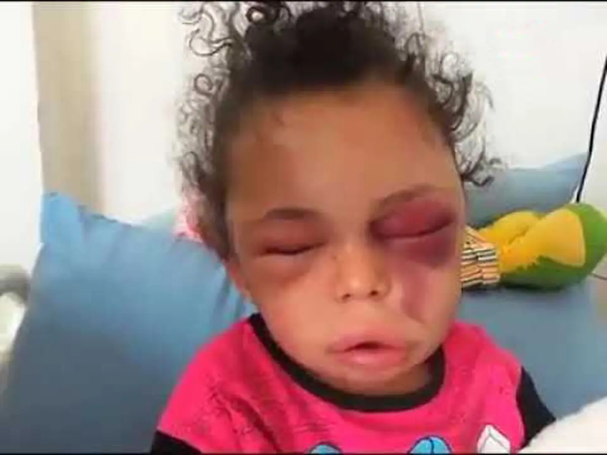 سرنوشت دختر ۵ ساله یمنی چه شد؟