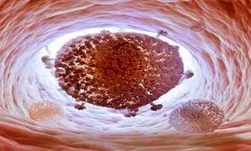 "HTLV1" را با ایدز اشتباه نگیرید