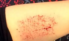 خودزنی سه دانش‌آموز اهوازی صحت ندارد