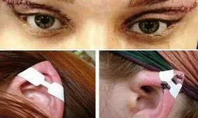 ماجرای «گوش الاغی‌ها و چشم گربه ی ها» به وزارت بهداشت هم رسید