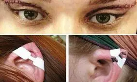 ماجرای «گوش الاغی‌ها و چشم گربه ی ها» به وزارت بهداشت هم رسید