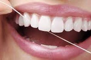 خلال دندان یا نخ دندان، کدام بهتر است؟