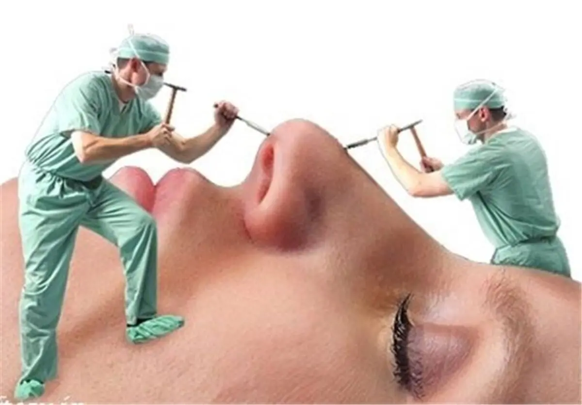 عوارض جراحی‌های ناشیانه زیبایی بینی