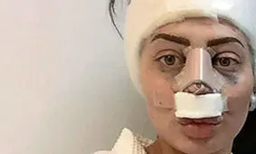 ستاره‌هایی که با عمل بینی، از این رو به آن رو شدند