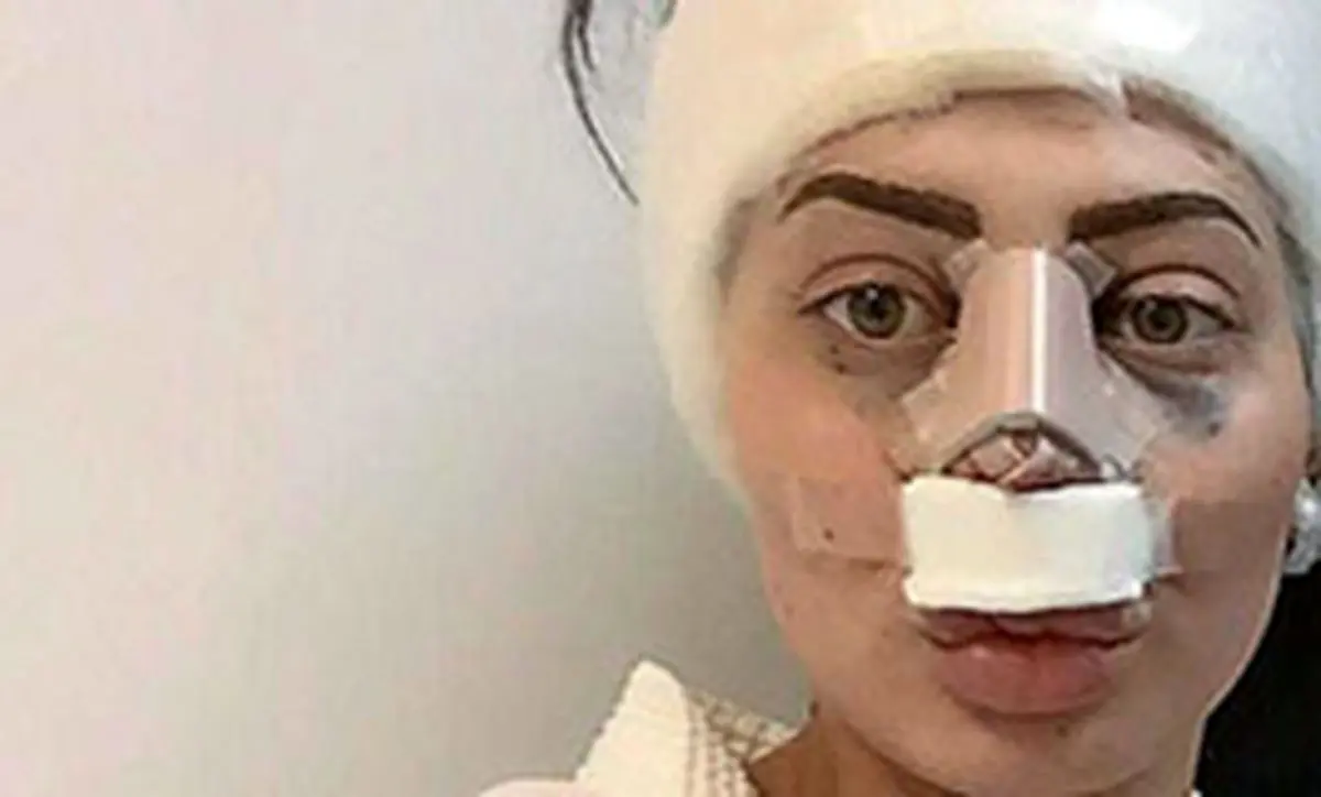 ستاره‌هایی که با عمل بینی، از این رو به آن رو شدند