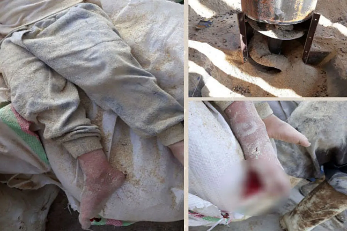 نجات کودک ۳ ساله از داخل دستگاه علوفه خرد کن در پیشوا