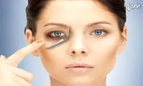 گودی زیر چشم، علت و درمان آن