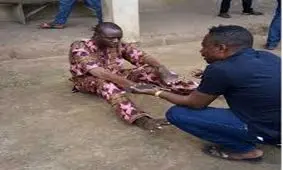 مردی که جای دست و پایش جابجا است!/عکس