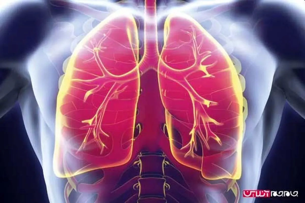 فرمول رهایی از قاتل درجه یک کودکان