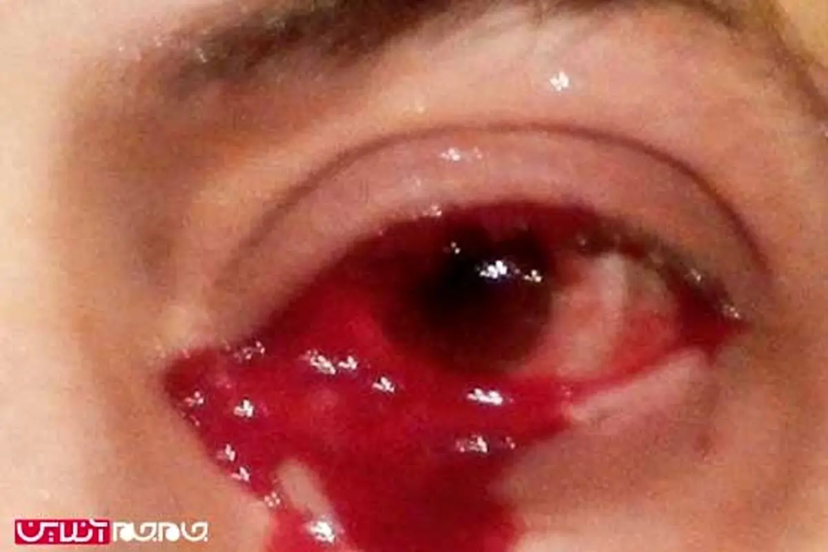 مرد ایتالیایی خون گریه کرد