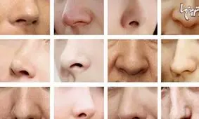 جراحی زیبایی بینی و انواع آن