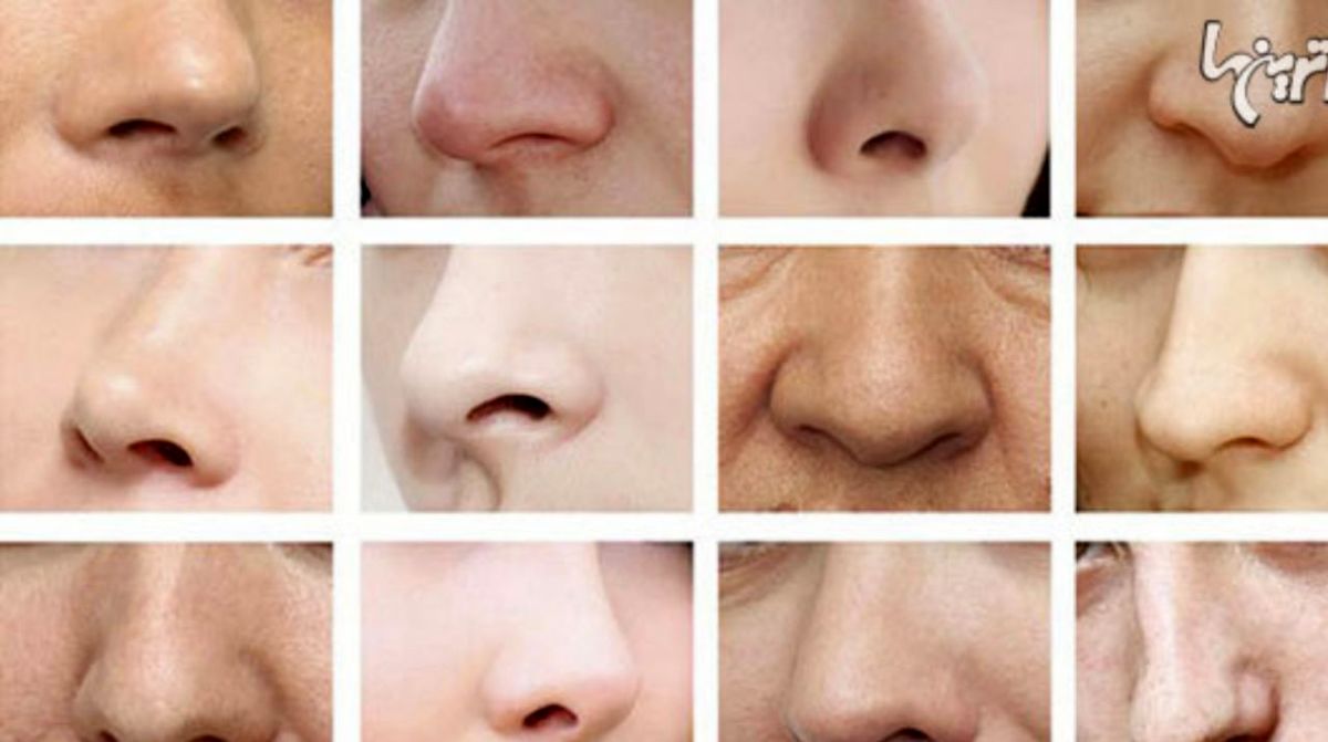 جراحی زیبایی بینی و انواع آن