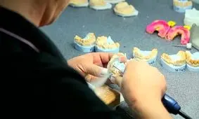 به زودی؛ پذیرش دانشجو در مقطع کارشناسی رشته پروتز