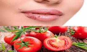 راهکاری برای درمان تبخال