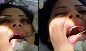 عجیب ترین و دردناک ترین روش لاغری در ونزوئلا
