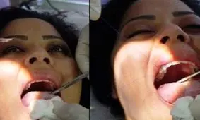 عجیب ترین و دردناک ترین روش لاغری در ونزوئلا