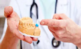 همه چیز درباره روکش دندان