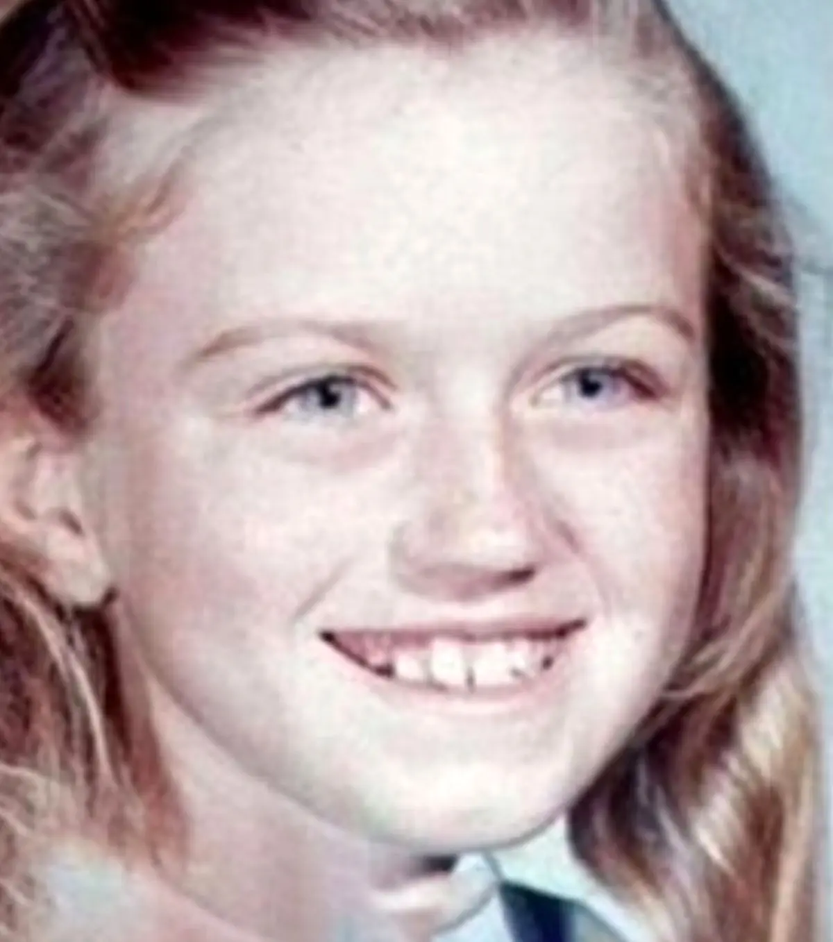 طولانی ترین کما/ دختری پس از 37 سال کما مُرد! + عکس