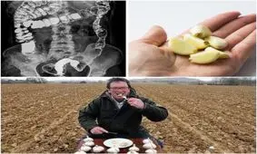 افزایش سیستم ایمنی بدن با سیر