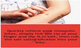 سریعترین راه تسکین درد و خارش ناشی از نیش حشرات