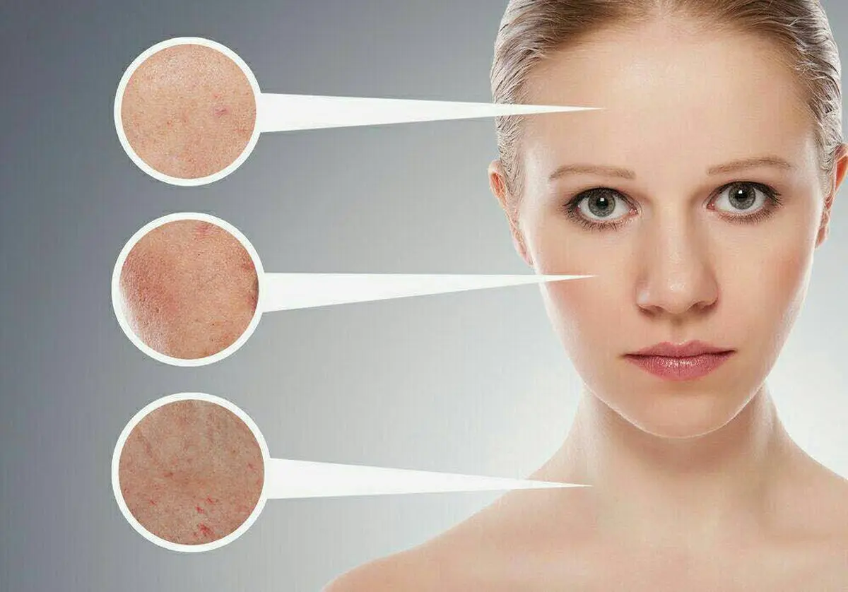 بیماری های پوستی ناشی از بدکاری کبد