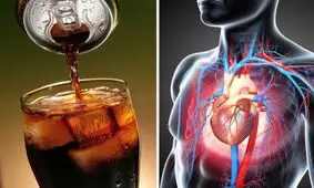 اگر بیش از دو روز در هفته نوشابه مصرف میکنید