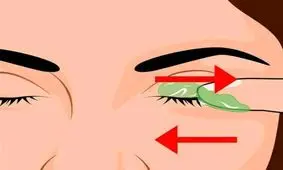 هر شب قبل از خواب مقداری ژل آلوئه ورا به پشت پلک خود بمالید