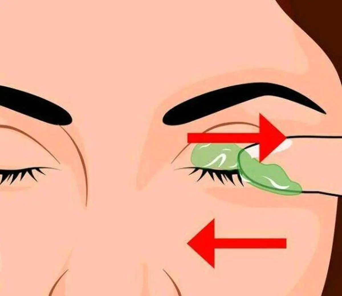 هر شب قبل از خواب مقداری ژل آلوئه ورا به پشت پلک خود بمالید