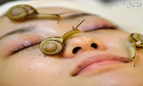 درمان‌های زیبایی عجیب و غریب در دنیا