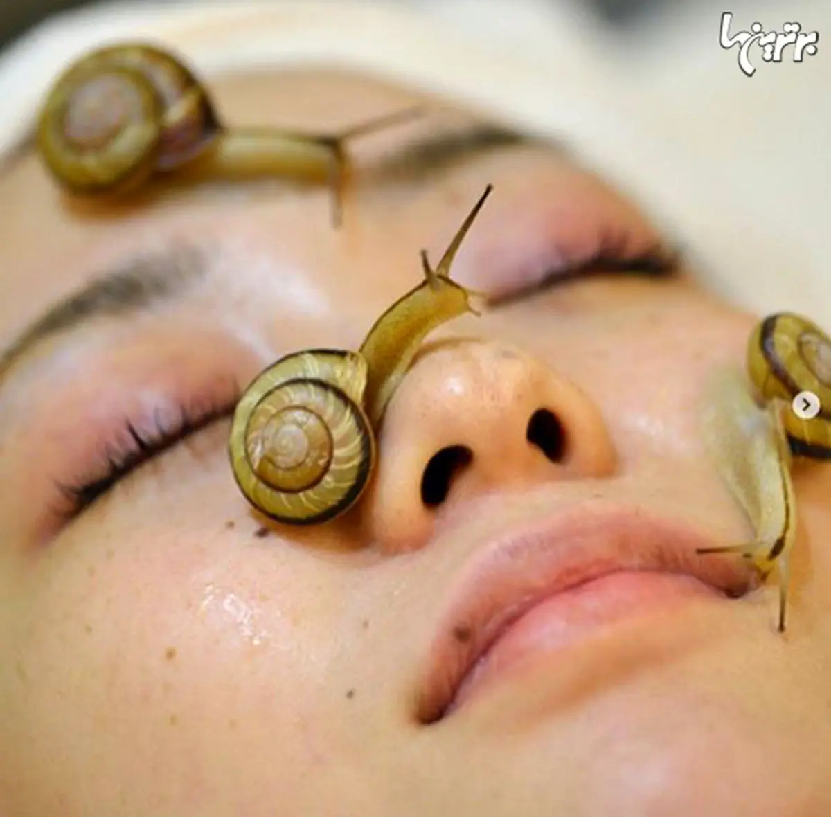 درمان‌های زیبایی عجیب و غریب در دنیا