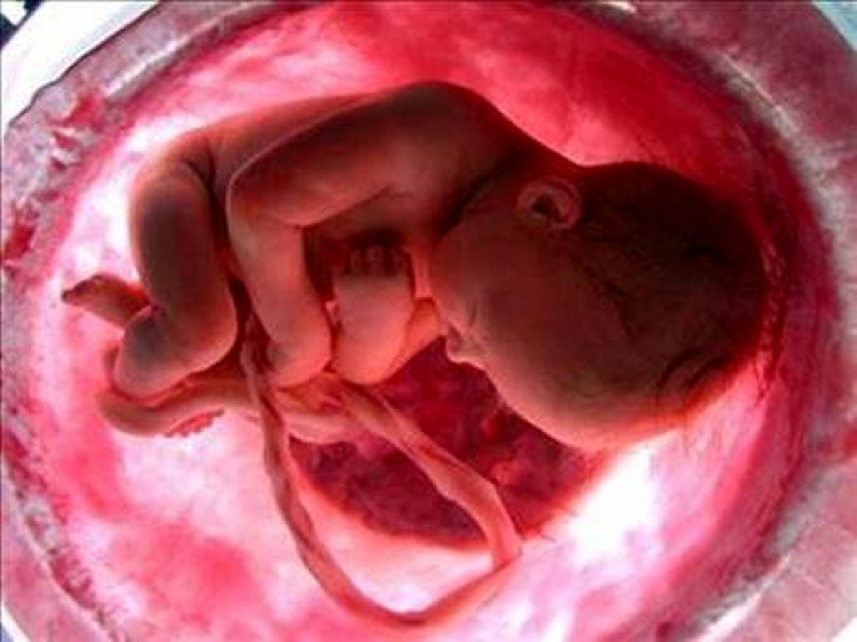 متولد شدن نخستین نوزادان با کمک اصلاح ژن