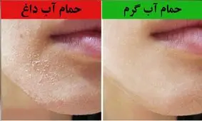 با آب داغ حمام نکنید