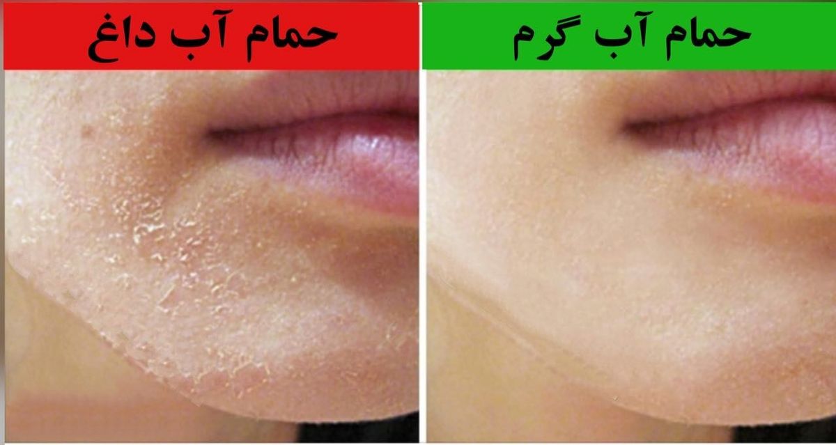 با آب داغ حمام نکنید