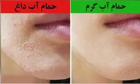 با آب داغ حمام نکنید