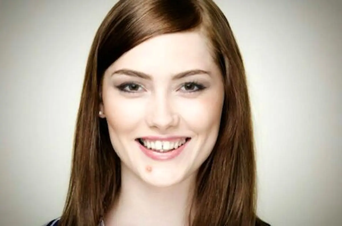 چطور قرمزی و التهاب جوش را ازبین ببریم؟