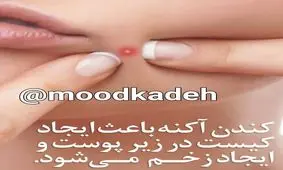 این نوع جوش ها را هرگز نترکانید!