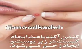 این نوع جوش ها را هرگز نترکانید!