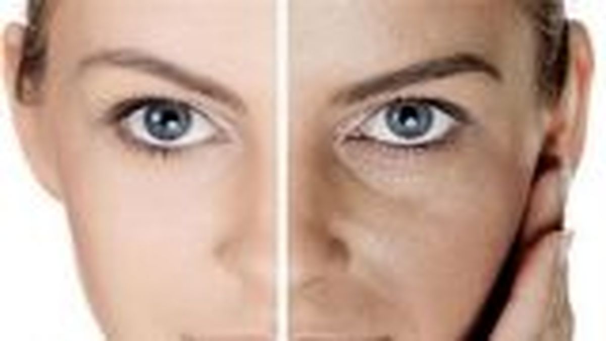۵ روش طبیعی برای خلاصی از ترکهای پوست