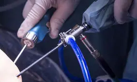 جراحی آرتروسکوپی زانو چیست و چه موقع باید انجام شود؟