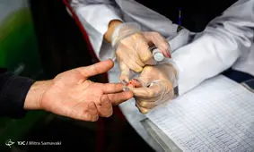 دیابت؛ شایع‌ترین علت کوری در جهان