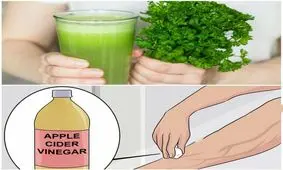 رابطه سرکه سیب و رگهای واریسی