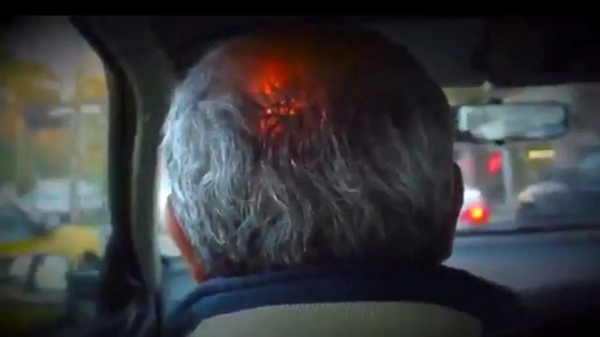 علائم سکته مغزی رو جدی بگیریم