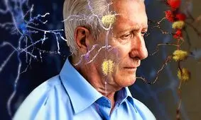 اگر از آلزایمر می‌ترسید مراقب ریه‌های خود باشید